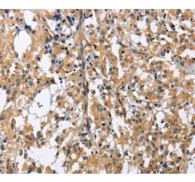 Immunohistochemistry - GAB1 Antibody from Signalway Antibody (36142) - Antibodies.com