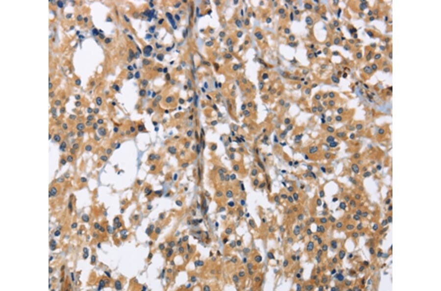 Immunohistochemistry - GAB1 Antibody from Signalway Antibody (36142) - Antibodies.com
