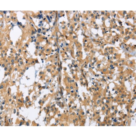 Immunohistochemistry - GAB1 Antibody from Signalway Antibody (36142) - Antibodies.com