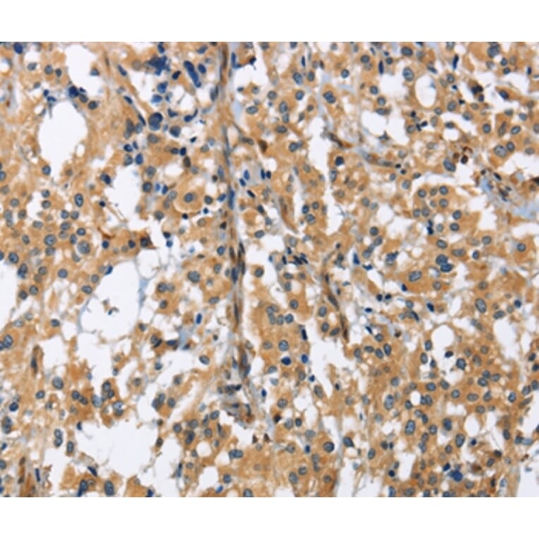 Immunohistochemistry - GAB1 Antibody from Signalway Antibody (36142) - Antibodies.com