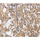 Immunohistochemistry - GAB1 Antibody from Signalway Antibody (36142) - Antibodies.com
