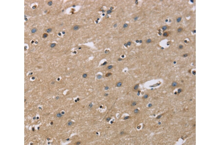 Immunohistochemistry - GAB1 Antibody from Signalway Antibody (36142) - Antibodies.com