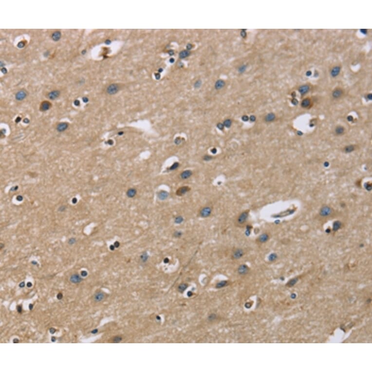 Immunohistochemistry - GAB1 Antibody from Signalway Antibody (36142) - Antibodies.com