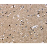 Immunohistochemistry - GAB1 Antibody from Signalway Antibody (36142) - Antibodies.com