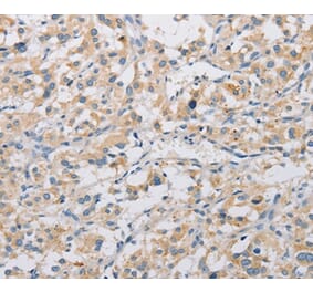 Immunohistochemistry - KAT5 Antibody from Signalway Antibody (36147) - Antibodies.com