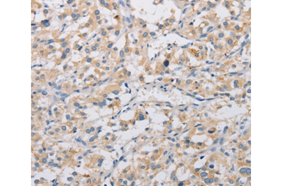 Immunohistochemistry - KAT5 Antibody from Signalway Antibody (36147) - Antibodies.com