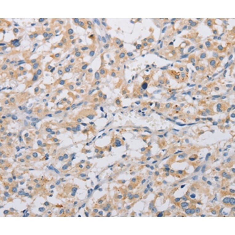 Immunohistochemistry - KAT5 Antibody from Signalway Antibody (36147) - Antibodies.com