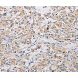 Immunohistochemistry - KAT5 Antibody from Signalway Antibody (36147) - Antibodies.com