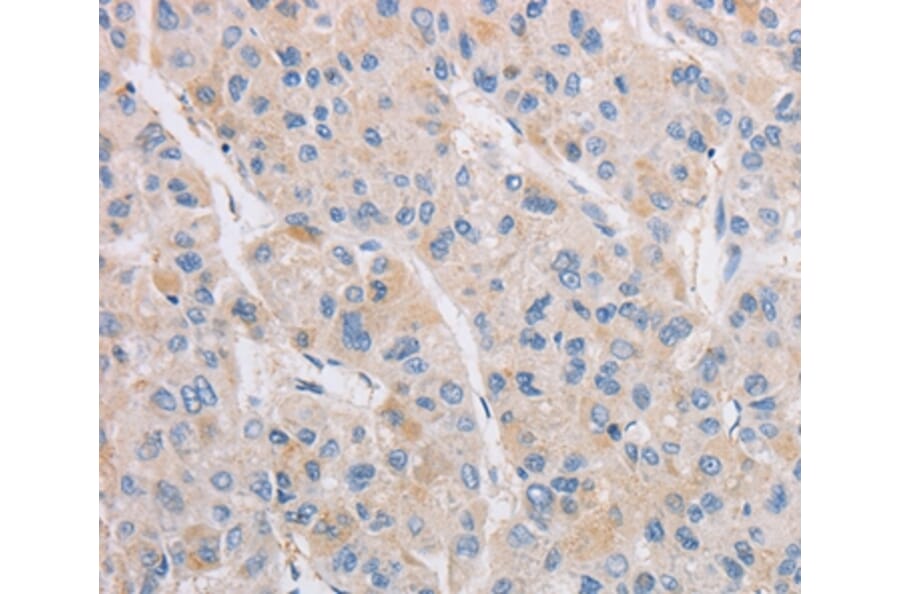 Immunohistochemistry - KAT5 Antibody from Signalway Antibody (36147) - Antibodies.com