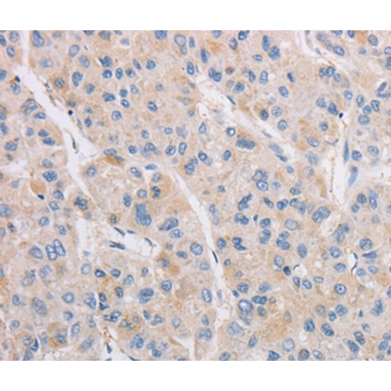 Immunohistochemistry - KAT5 Antibody from Signalway Antibody (36147) - Antibodies.com