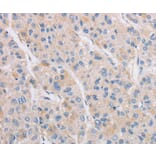 Immunohistochemistry - KAT5 Antibody from Signalway Antibody (36147) - Antibodies.com