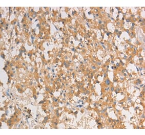 Immunohistochemistry - ART3 Antibody from Signalway Antibody (36154) - Antibodies.com
