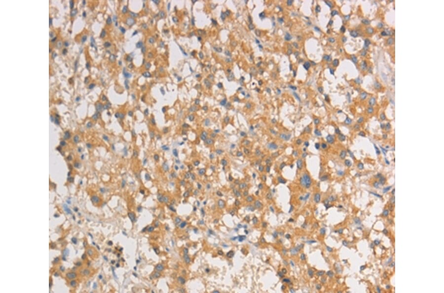 Immunohistochemistry - ART3 Antibody from Signalway Antibody (36154) - Antibodies.com