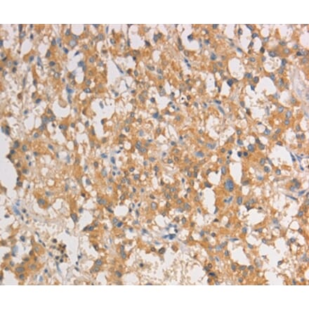 Immunohistochemistry - ART3 Antibody from Signalway Antibody (36154) - Antibodies.com