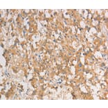 Immunohistochemistry - ART3 Antibody from Signalway Antibody (36154) - Antibodies.com