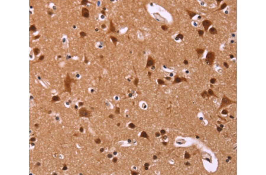 Immunohistochemistry - ART5 Antibody from Signalway Antibody (36155) - Antibodies.com