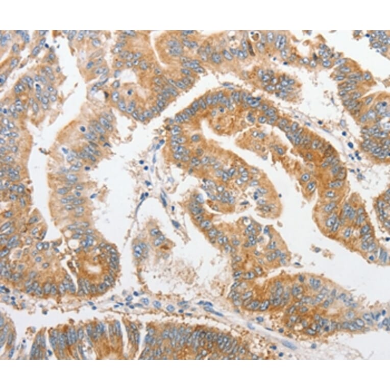 Immunohistochemistry - ALPI Antibody from Signalway Antibody (36164) - Antibodies.com