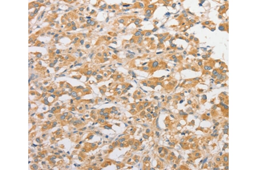 Immunohistochemistry - TLR5 Antibody from Signalway Antibody (36165) - Antibodies.com