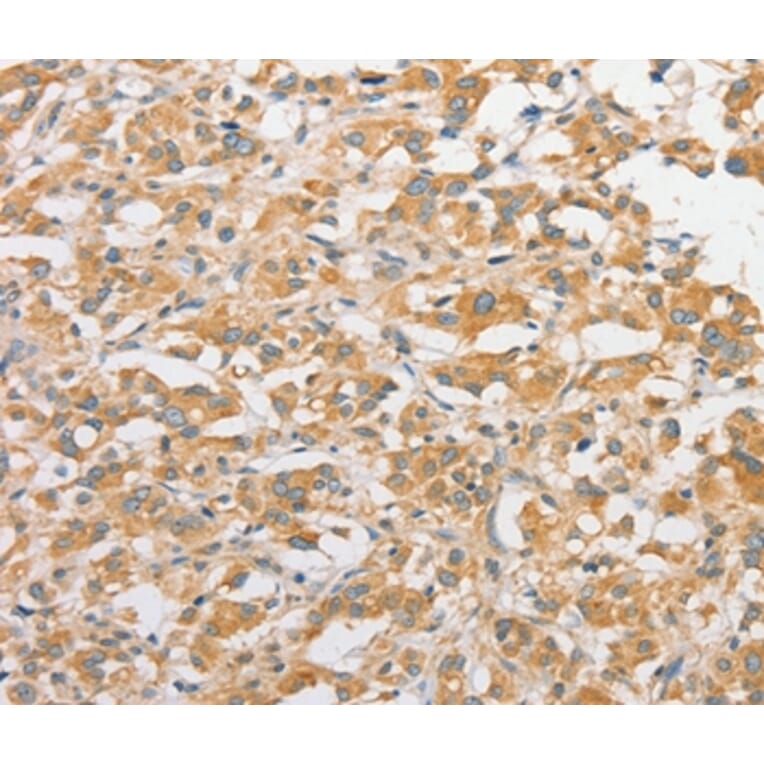 Immunohistochemistry - TLR5 Antibody from Signalway Antibody (36165) - Antibodies.com