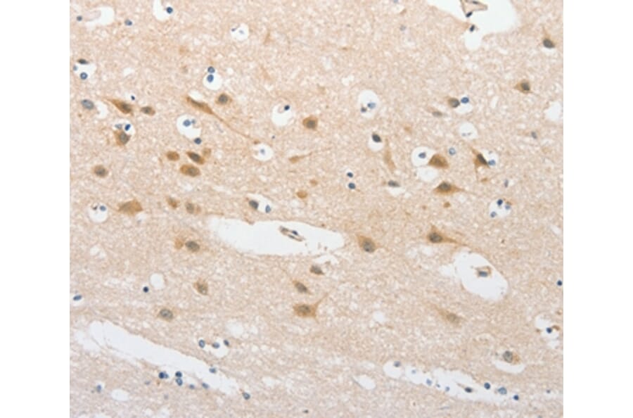 Immunohistochemistry - TLR5 Antibody from Signalway Antibody (36165) - Antibodies.com