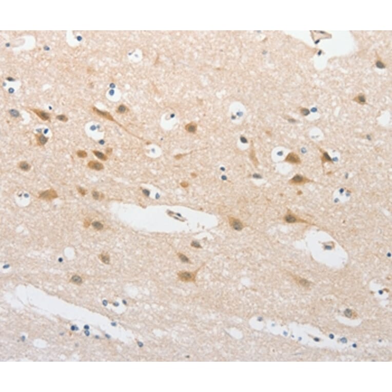 Immunohistochemistry - TLR5 Antibody from Signalway Antibody (36165) - Antibodies.com