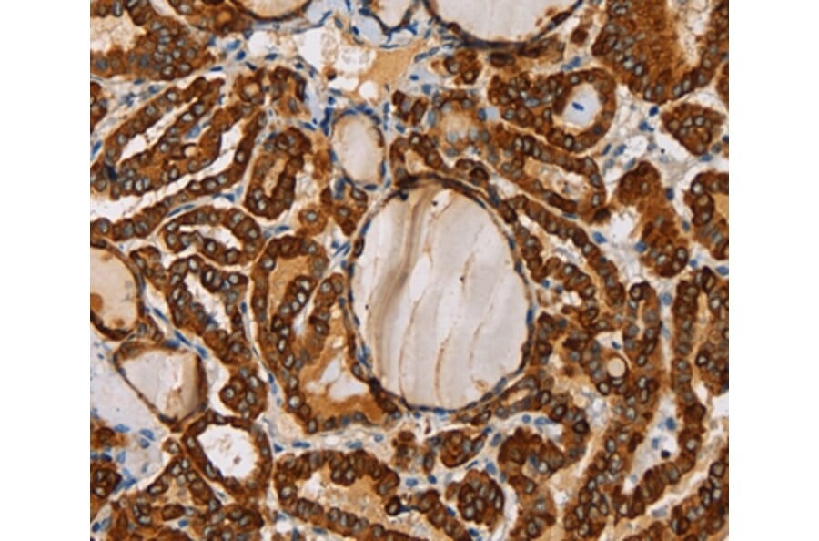 Immunohistochemistry - TLR6 Antibody from Signalway Antibody (36166) - Antibodies.com