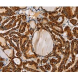 Immunohistochemistry - TLR6 Antibody from Signalway Antibody (36166) - Antibodies.com