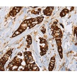 Immunohistochemistry - TLR6 Antibody from Signalway Antibody (36166) - Antibodies.com