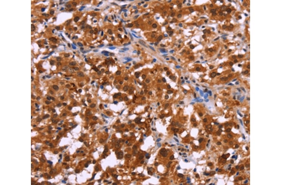 Immunohistochemistry - USP2 Antibody from Signalway Antibody (36169) - Antibodies.com