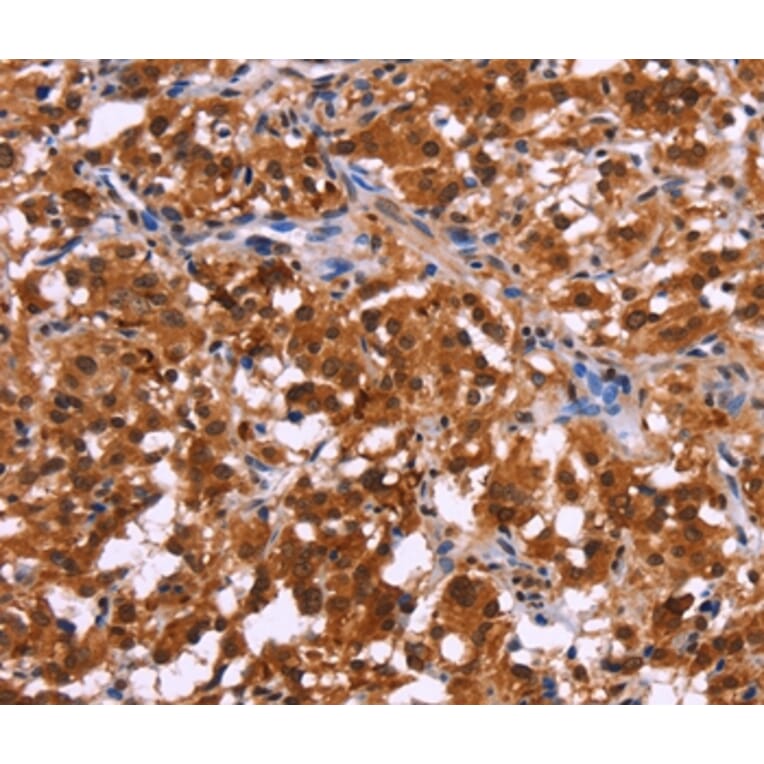 Immunohistochemistry - USP2 Antibody from Signalway Antibody (36169) - Antibodies.com