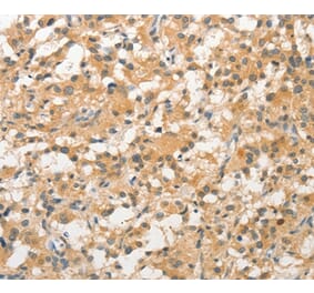 Immunohistochemistry - STAM Antibody from Signalway Antibody (36172) - Antibodies.com