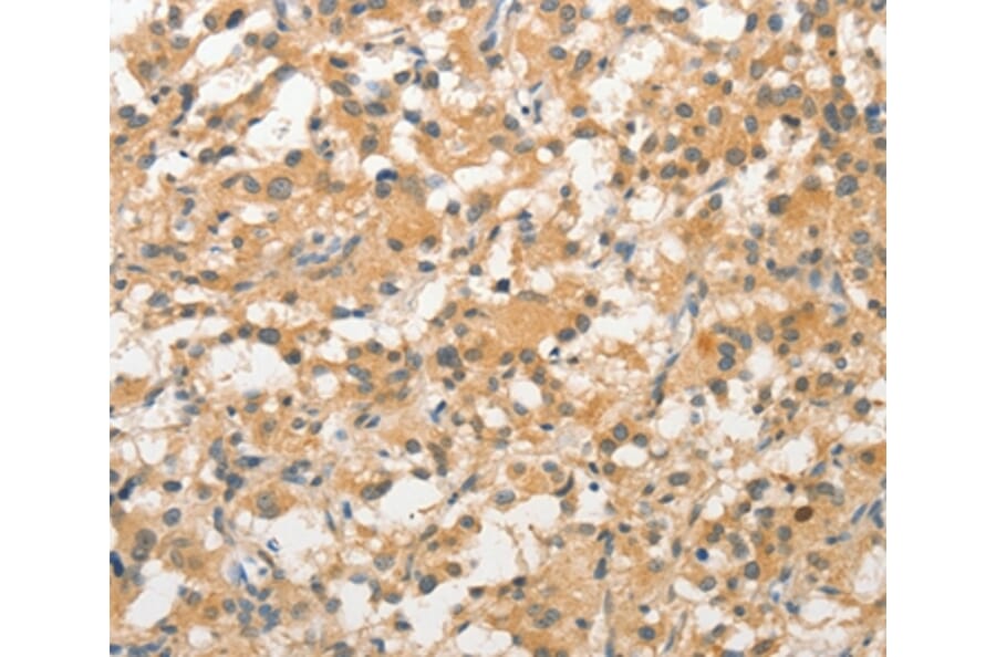 Immunohistochemistry - STAM Antibody from Signalway Antibody (36172) - Antibodies.com