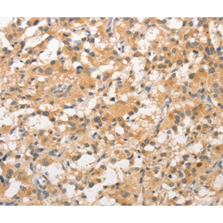 Immunohistochemistry - STAM Antibody from Signalway Antibody (36172) - Antibodies.com
