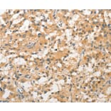 Immunohistochemistry - STAM Antibody from Signalway Antibody (36172) - Antibodies.com