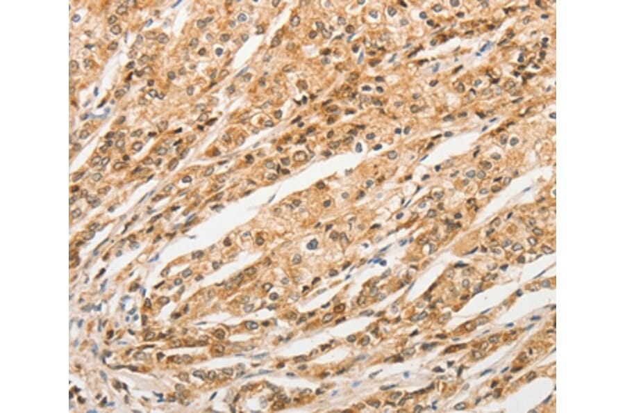 Immunohistochemistry - STAM Antibody from Signalway Antibody (36172) - Antibodies.com