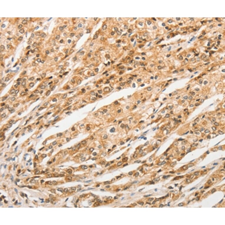 Immunohistochemistry - STAM Antibody from Signalway Antibody (36172) - Antibodies.com