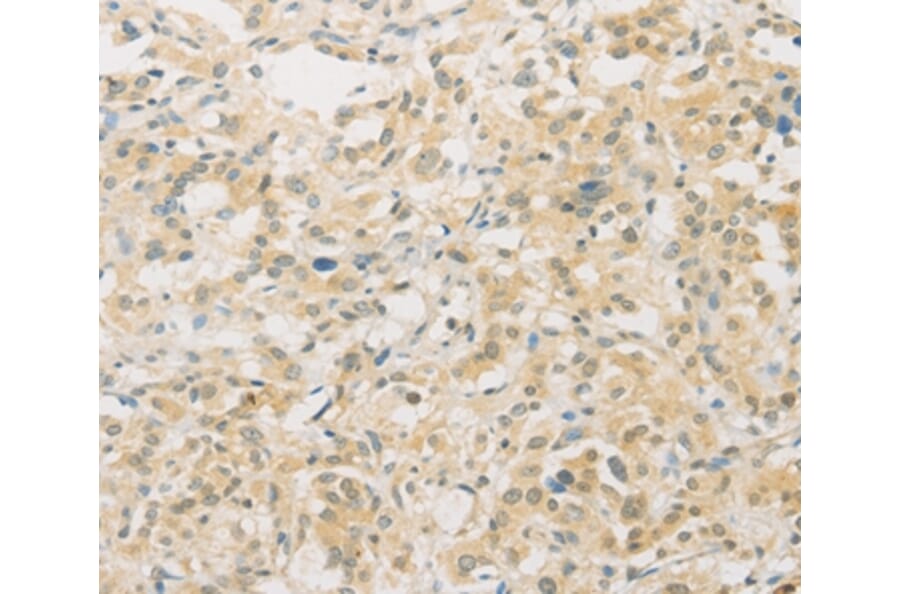 Immunohistochemistry - FNTA Antibody from Signalway Antibody (36174) - Antibodies.com