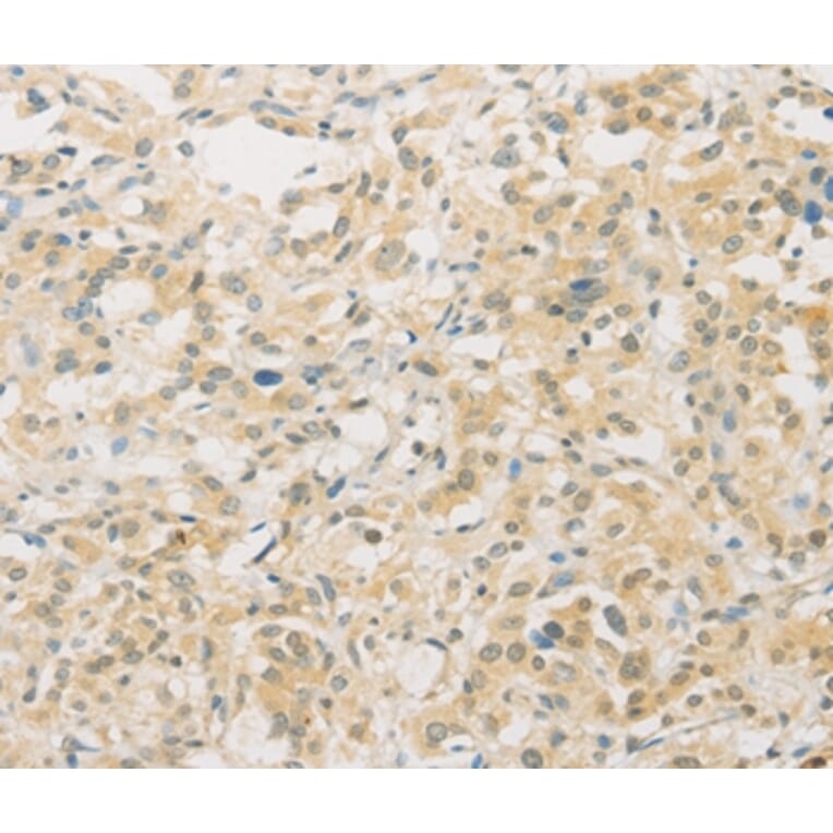 Immunohistochemistry - FNTA Antibody from Signalway Antibody (36174) - Antibodies.com