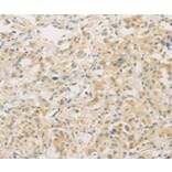 Immunohistochemistry - FNTA Antibody from Signalway Antibody (36174) - Antibodies.com