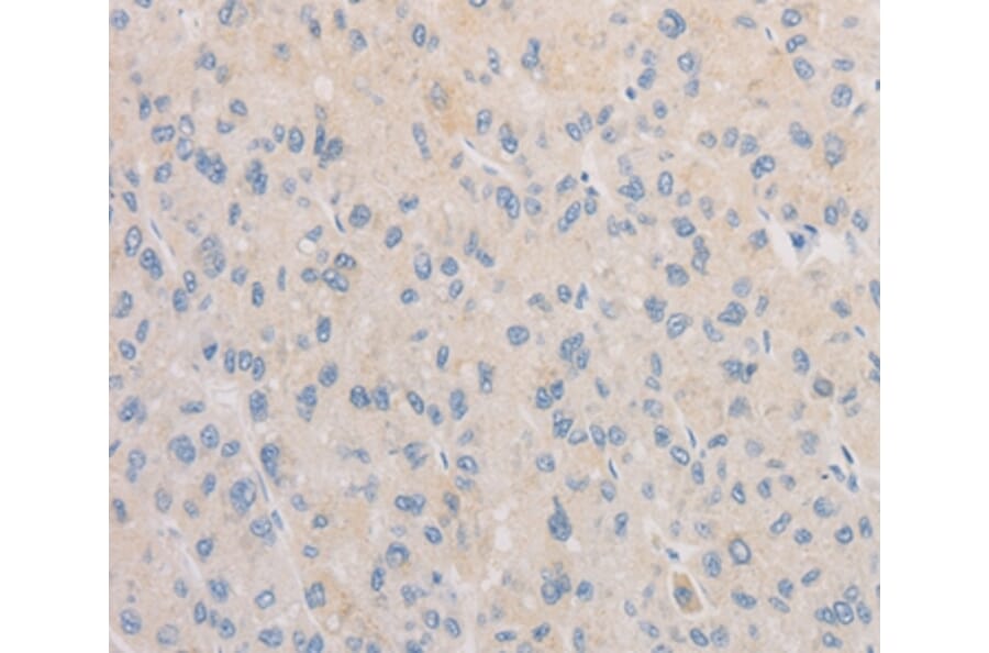 Immunohistochemistry - FNTA Antibody from Signalway Antibody (36174) - Antibodies.com