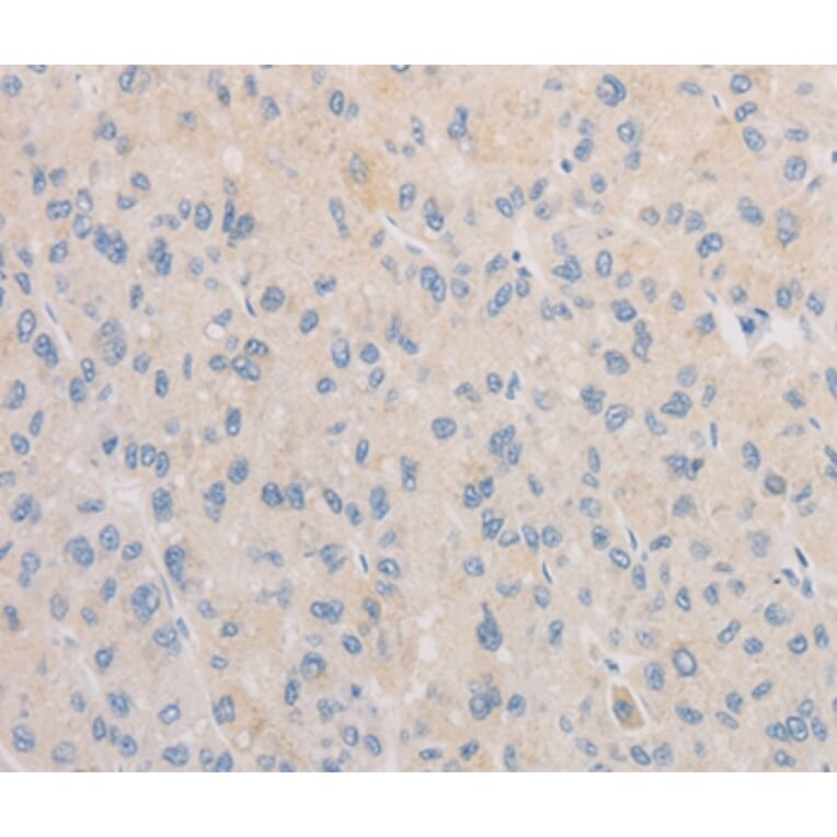 Immunohistochemistry - FNTA Antibody from Signalway Antibody (36174) - Antibodies.com