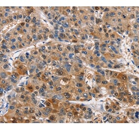 Immunohistochemistry - PIM1 Antibody from Signalway Antibody (36202) - Antibodies.com