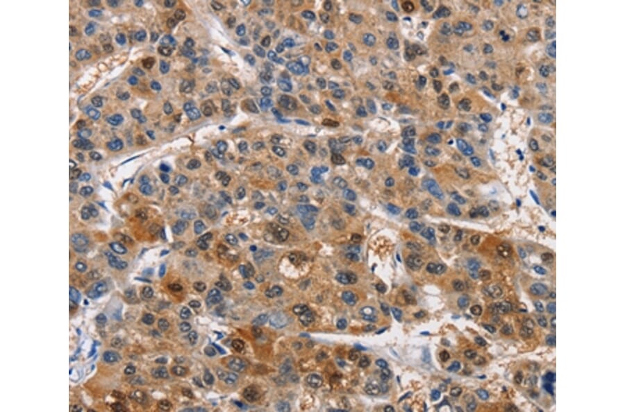 Immunohistochemistry - PIM1 Antibody from Signalway Antibody (36202) - Antibodies.com