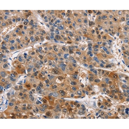Immunohistochemistry - PIM1 Antibody from Signalway Antibody (36202) - Antibodies.com