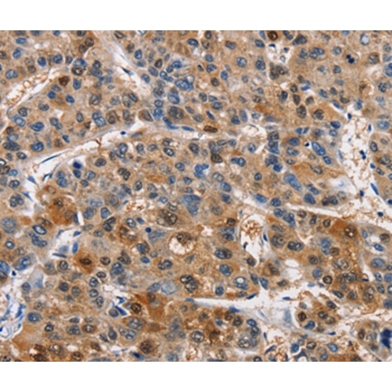 Immunohistochemistry - PIM1 Antibody from Signalway Antibody (36202) - Antibodies.com