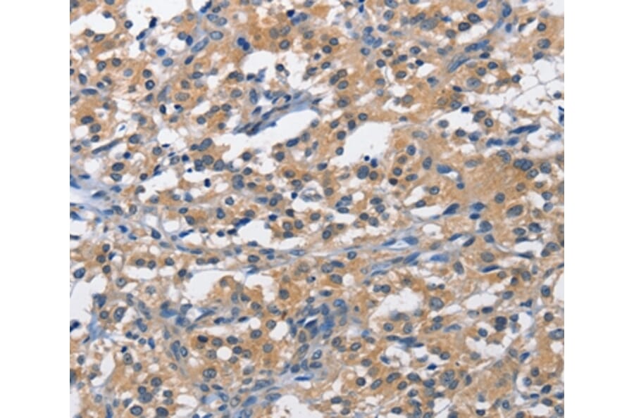 Immunohistochemistry - PIM1 Antibody from Signalway Antibody (36202) - Antibodies.com