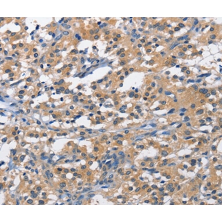 Immunohistochemistry - PIM1 Antibody from Signalway Antibody (36202) - Antibodies.com