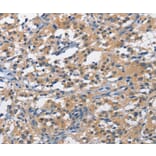 Immunohistochemistry - PIM1 Antibody from Signalway Antibody (36202) - Antibodies.com