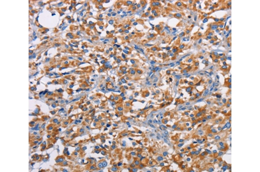Immunohistochemistry - PIM2 Antibody from Signalway Antibody (36203) - Antibodies.com