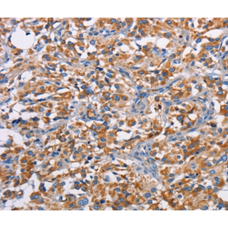 Immunohistochemistry - PIM2 Antibody from Signalway Antibody (36203) - Antibodies.com